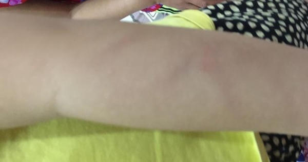 Con bị cô giáo đánh, phụ huynh đòi bồi thường 100 triệu đồng