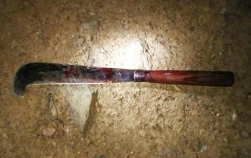 Khởi tố đối tượng chém đứt bàn tay của vợ cũ