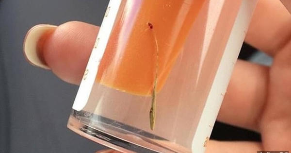 Cây mọc xanh mướt trong lỗ tai thiếu nữ