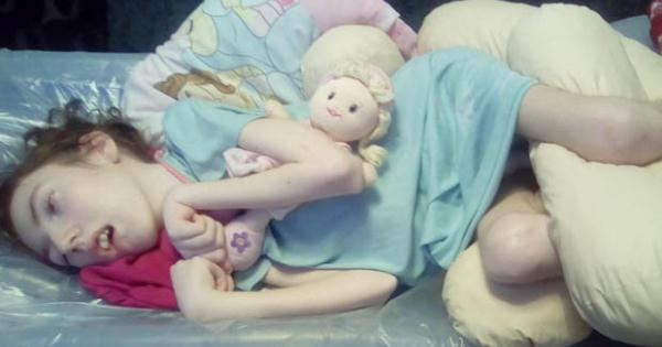 Nụ hôn đầu tiên của người mẹ khiến bé gái tật nguyền suốt đời