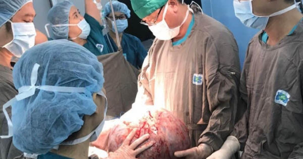 Mang khối u buồng trứng nặng 20kg, người phụ nữ 29 tuổi không thể đi lại Mang khối u buồng trứng nặng 20kg, người phụ nữ 29 tuổi không thể đi lại