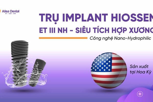 Nha khoa Alisa: Trồng răng Implant áp dụng công nghệ 5 Fast