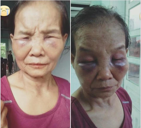 Sốc với hành vi con dâu đánh mẹ chồng túi bụi