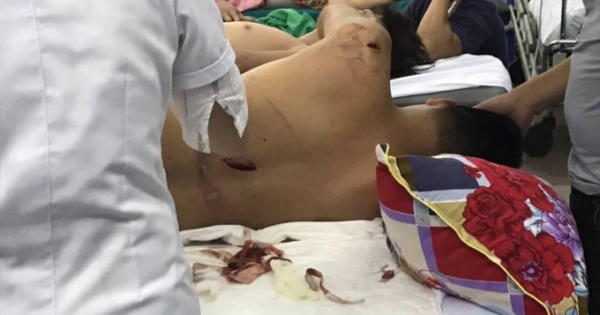 Hà Tĩnh: Nhóm côn đồ bịt mặt dùng kiếm truy sát nam thanh niên Hà Tĩnh: Nhóm côn đồ bịt mặt dùng kiếm truy sát nam thanh niên