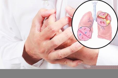 Tăng cường công tác phòng chống bệnh dịch viêm phổi cấp do chủng vi rút Corona mới