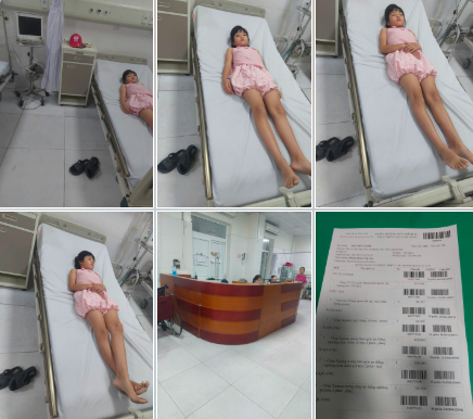 Thầy giáo thể dục "đánh vào tay" nữ học sinh lớp 5, phụ huynh phải đưa con đi khám bệnh viện