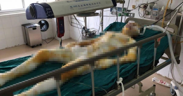 Làm rõ nghi án cô gái bị thiêu sống tại Vĩnh Phúc