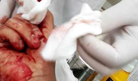 Phó Thủ tướng chỉ đạo làm rõ đối tượng hành hung nhà báo Đỗ Doãn Hoàng