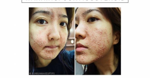 Mỹ phẩm nhau thai cừu phấn hoa NAK Q10 từng bị cơ quan chức năng phạt vì chưa công bố chất lượng sản phẩm Mỹ phẩm nhau thai cừu phấn hoa NAK Q10 từng bị cơ quan chức năng phạt vì chưa công bố chất lượng sản phẩm