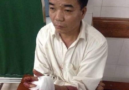 Chủ tịch HĐQT Trường Lomonoxop chém một bảo vệ trọng thương