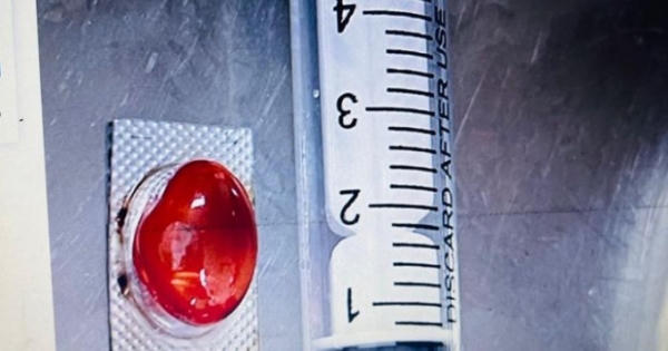 Uống thuốc không bóc vỏ, cụ ông tại Hà Tĩnh nhập viện cấp cứu