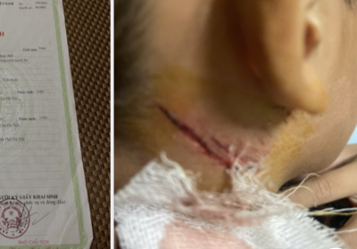 Thanh Oai - Hà Nội: Điều tra vụ cháu bé 11 tuổi bị cứa cổ, hành hạ khi câu trộm cá nhà hàng xóm