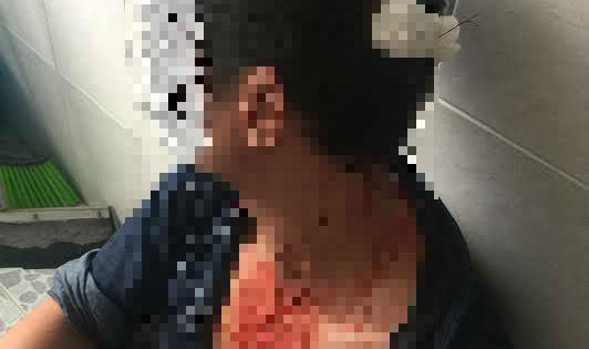 Kỳ 3 - Bệnh viện 115 đưa thiếu hồ sơ bệnh án để công an giám định thương tích? Kỳ 3 - Bệnh viện 115 đưa thiếu hồ sơ bệnh án để công an giám định thương tích?