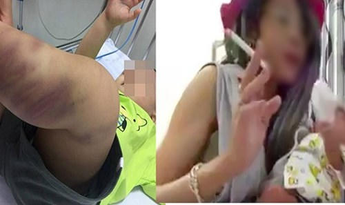 Trẻ em bị xâm hại, ngược đãi gần đây: Luật đã có, đừng chần chừ! Trẻ em bị xâm hại, ngược đãi gần đây: Luật đã có, đừng chần chừ!