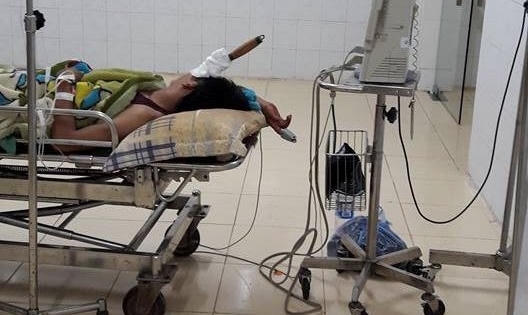 Thanh Hóa: Mâu thuẫn, nam thanh niên cầm dao đâm thủng đầu bạn