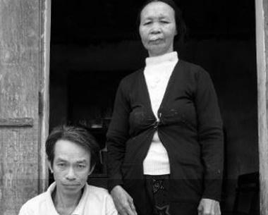 Cảm động một chuyện tình “đũa lệch”