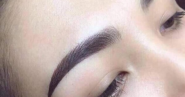Nguyên ĐBQH tử vong sau làm đẹp: Lời khuyên "vàng" của bác sĩ thẩm mỹ