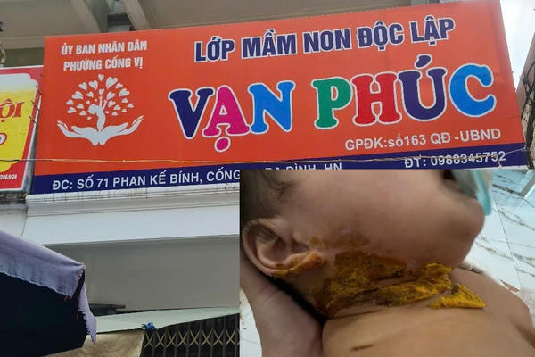 Vụ cháu bé 9 tháng tuổi bị bỏng tại Lớp mầm non Độc Lập Vạn Phúc: Không bao che cho sai phạm