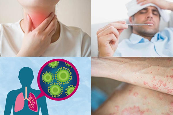 Bắc Giang khẩn cấp cách ly người tiếp xúc gần với nữ sinh mắc bệnh bạch hầu