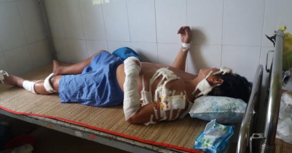 Vĩnh Long: Ghen tuông, vợ vác dao chém chồng suýt chết