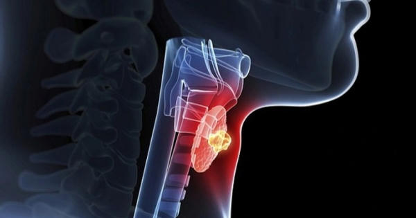 Phát hiện u tuyến giáp lành tính có cần phẫu thuật?