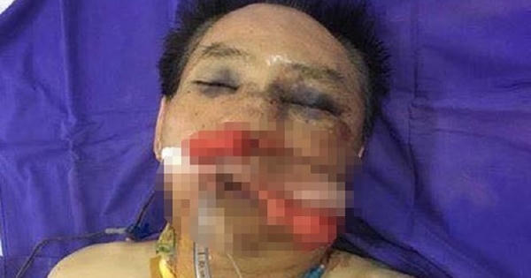 Khởi tố nguyên đại tá công an hành hung vợ chồng anh trai vì tranh chấp đất