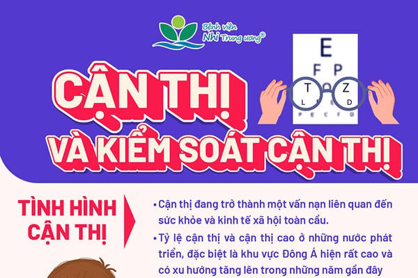 Nguy cơ gia tăng trẻ cận thị sau kỳ nghỉ hè