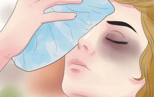 Các cách xử lý một số tai nạn mắt ngay tại nhà