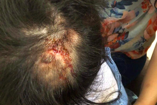 Hà Tĩnh: Khởi tố vụ án dì ruột hành hạ cháu gái 4 tuổi để điều tra