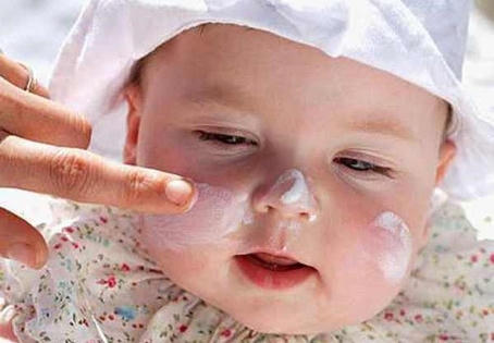 Rôm sảy là gì? Cách phòng tránh và chữa trị rôm sảy hiệu quả?