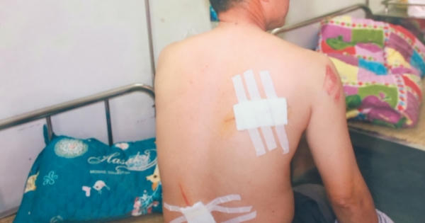 Ninh Bình: Phụ xe côn đồ, cầm kiếm chém người trọng thương tại bến xe