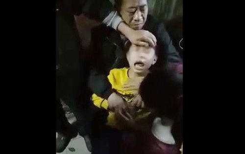 Bác sĩ nói gì về hiện tượng bé trai nghi phát bệnh dại kêu "oắc oắc"?