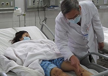 “Đối phó” với bệnh do não mô cầu, Bộ Y tế ra công văn khẩn