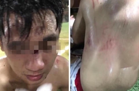 Cận cảnh Clip đội bóng xăm trổ đánh hội đồng đối phương sau khi thua trận