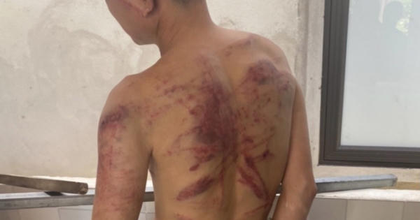 “Nữ quái” cho vay nặng lãi “tra tấn” con nợ bằng dây điện “Nữ quái” cho vay nặng lãi “tra tấn” con nợ bằng dây điện