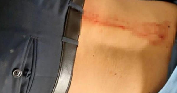 Đắk Nông: Bị nhắc nhở, nữ tiểu thương tấn công cán bộ QLTT