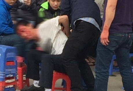 Cán bộ Đại học Điện lực bị lái xe biển xanh 80A hành hung