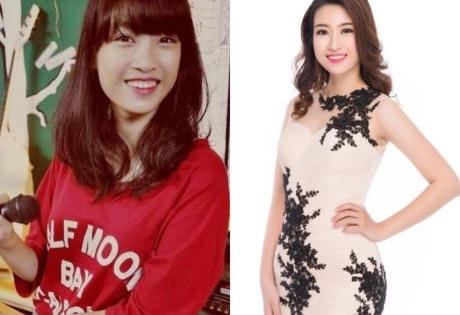 Vừa đăng quang, Tân Hoa hậu VN 2016 dính nghi án sửa răng