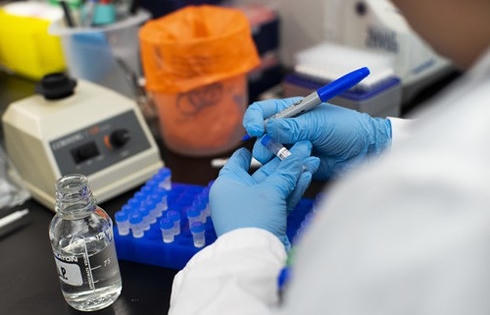 Người dân có được xét nghiệm Covid-19 theo yêu cầu không? Người dân có được xét nghiệm Covid-19 theo yêu cầu không?