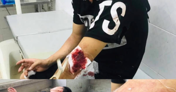 Bắt giam Trương Phú Hồng, kẻ kích động vụ hỗn chiến ở biển Hải Tiến