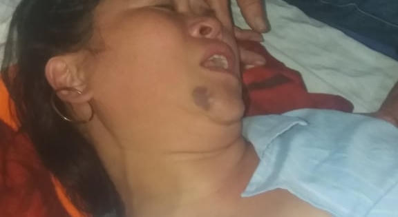 Người phụ nữ bị đánh chấn thương sọ não vì “chửi đổng” chuyện vứt rác bừa bãi