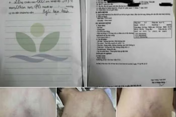 Bộ Y tế thông tin về việc cháu bé 4 tuổi bị bạo hành tại trường mầm non Gia Thụy