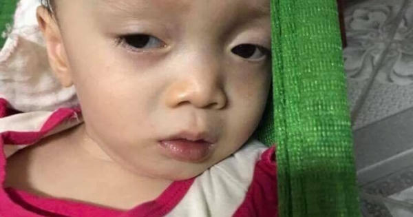 Xoa dịu nỗi đau của em bé 14 tháng tuổi vừa mất mẹ lại bị bệnh u não