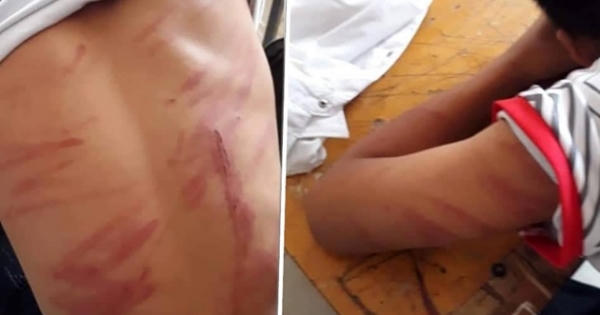 Hé lộ nguyên nhân của người bố đánh con ngất xỉu phải nhập viện