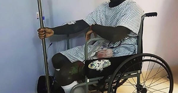 Cho rằng ảnh hưởng tới cái đẹp, người đàn ông cắt luôn "của quý" Cho rằng ảnh hưởng tới cái đẹp, người đàn ông cắt luôn "của quý"