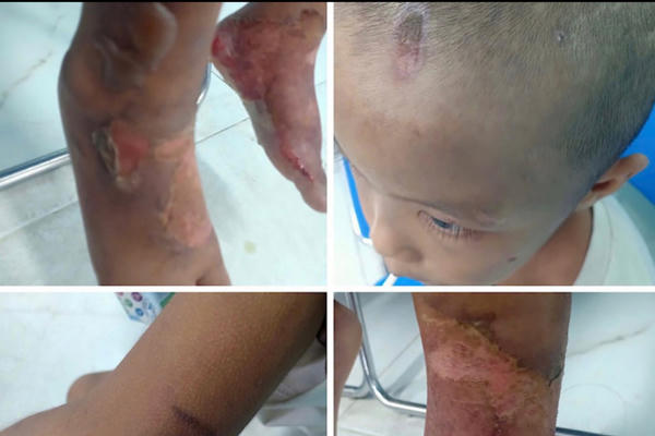 Cảnh sát truy tìm người nghi bạo hành con trai 6 tuổi ở TP HCM Cảnh sát truy tìm người nghi bạo hành con trai 6 tuổi ở TP HCM