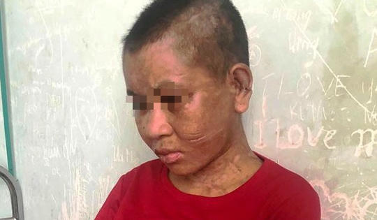 Đánh người làm thuê dã man ở Gia Lai: Quỷ thần cũng phải kinh hãi
