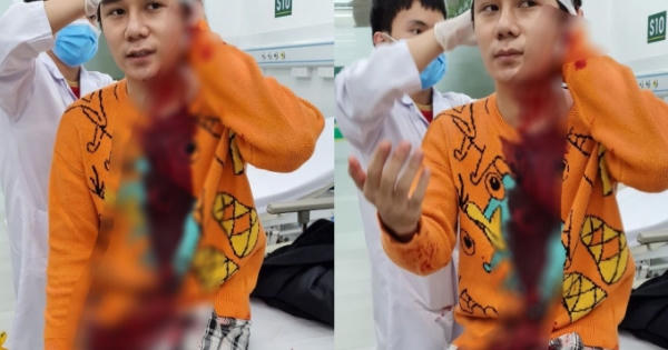 Khởi tố vụ án diễn viên phim 'Thương ngày nắng về' bị chém trọng thương Khởi tố vụ án diễn viên phim 'Thương ngày nắng về' bị chém trọng thương