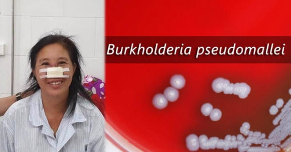 Bệnh nhân Whitmore tổn thương mũi đã được xuất viện