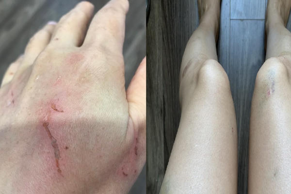 Trình dược viên vô cớ bị hành hung